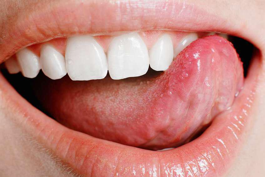 医用黄腐酸在人体口腔上的应用及医用黄腐酸的使用方法